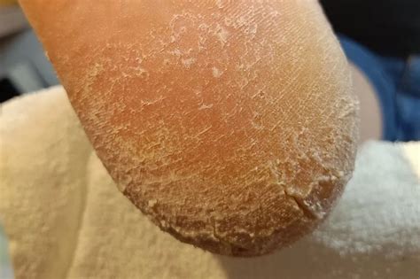 Ilustrácia pier v rôznych stavoch: zdravé, suché, popraskané.