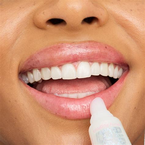 Ilustrácia znázorňujúca správne prikladanie studeného obkladu na pery