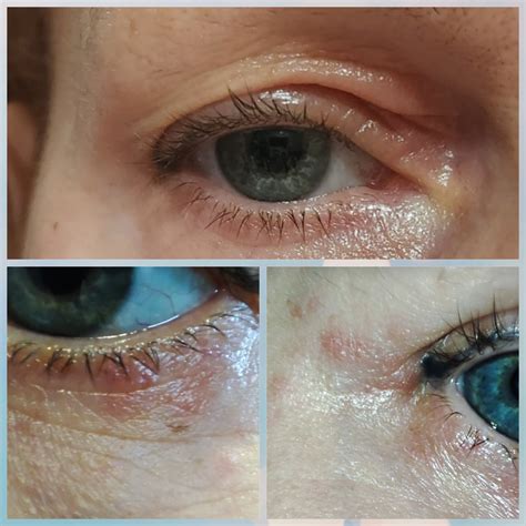 Ilustračná fotografia ženy s jemnými vráskami okolo očí