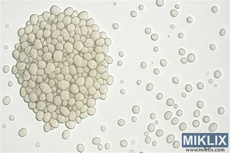 Mikroskopický pohľad na dermálny névus.