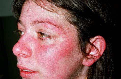 Ilustrácia rôznych typov kožných vyrážok a ich bežných príčin