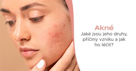 Ilustrácia mechanizmu vzniku akné v kožnom póre