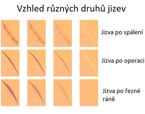 Zobrazenie rany po zašití