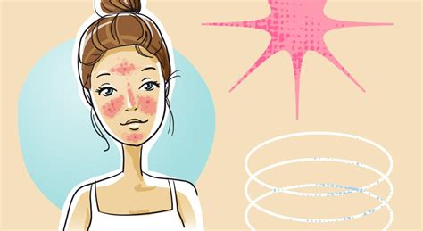 Ilustrácia detskej pokožky s bežnými vyrážkami