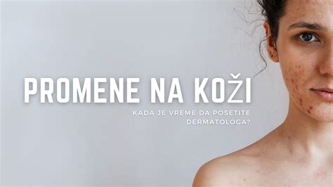 Ilustrácia zobrazujúca typický keloidný jazvu na koži.