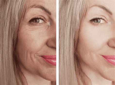 porovnanie tváre s vráskami a bez vrások
