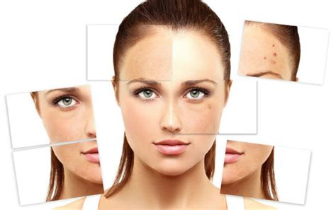 Ilustračná fotografia rôznych typov pleti s rôznymi potrebami